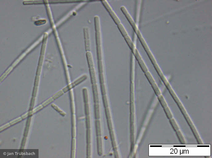 Pseudanabaena_catenata_1252661697 - Cyanobacteria Cyanobacteria Oscillatoriales Pseudanabaena catenata