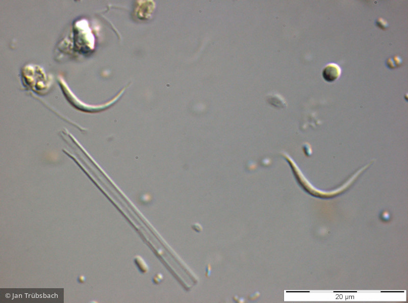 Chlorophyta Chlorophyceae Chlorococcales Monoraphidium contortum