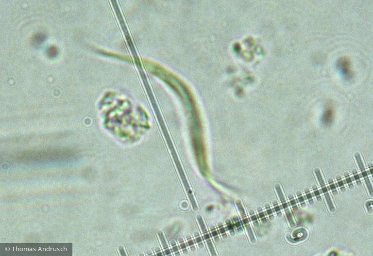 Chlorophyta Chlorophyceae Chlorococcales Monoraphidium contortum