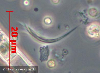 Chlorophyta Chlorophyceae Chlorococcales Monoraphidium contortum