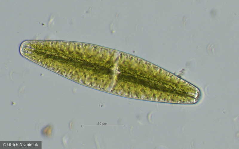 Chlorophyta Conjugatophyceae Zygnematales Netrium digitus
