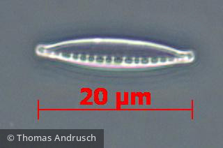 Heterocontophyta Bacillariophyceae Pennales Nitzschia dissipata