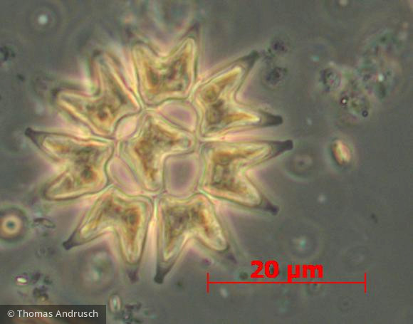 Chlorophyta Chlorophyceae Chlorococcales Pediastrum duplex