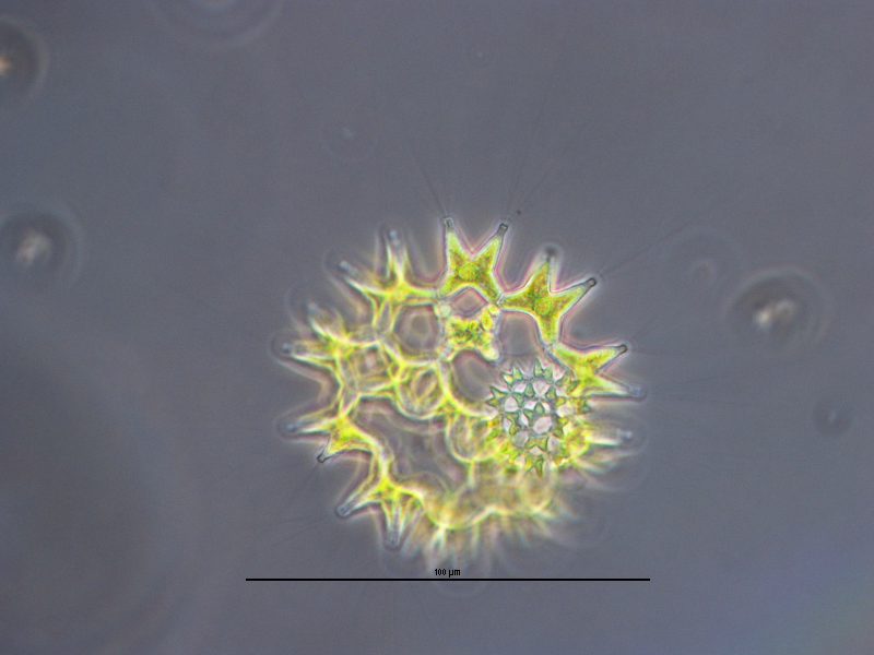 Chlorophyta Chlorophyceae Chlorococcales Pediastrum duplex