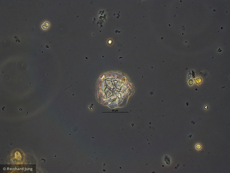 Dinophyta Dinophyceae Peridiniales Peridiniopsis elpatiewskyi