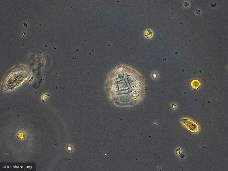 Dinophyta Dinophyceae Peridiniales Peridiniopsis elpatiewskyi