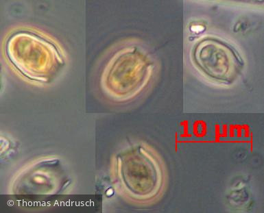 Heterocontophyta Chrysophyceae Chromulinales Pseudokephyrion entzii