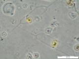 Rhizosolenia_eriensis_1235654201