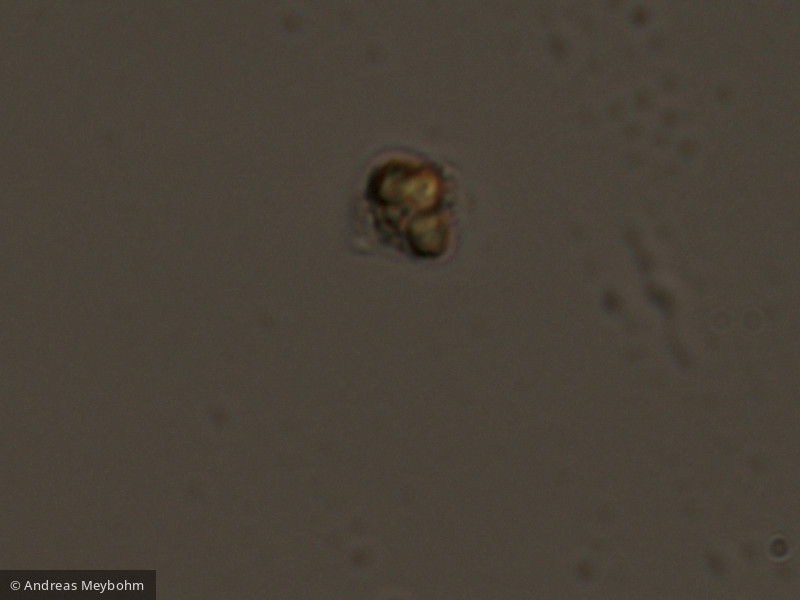 Pseudopedinella_erkennsis_1254136860 - Heterocontophyta Chrysophyceae Ochromonadales Pseudopedinella erkensis