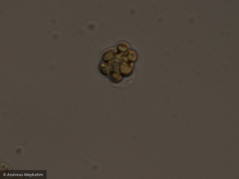 Pseudopedinella_erkennsis_1254137202 - Heterocontophyta Chrysophyceae Ochromonadales Pseudopedinella erkensis