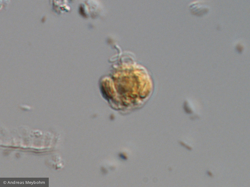 Heterocontophyta Chrysophyceae Ochromonadales Pseudopedinella erkensis