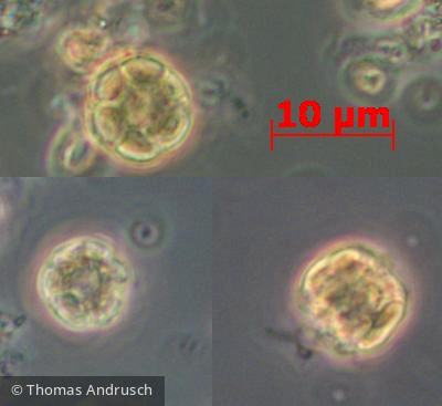 Heterocontophyta Chrysophyceae Ochromonadales Pseudopedinella erkensis