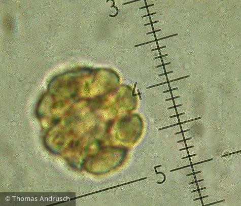 Heterocontophyta Chrysophyceae Ochromonadales Pseudopedinella erkensis