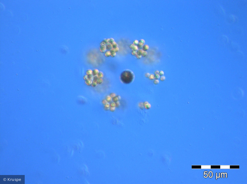 Planktosphaeria_gelatinosa_1260784021 - Chlorophyta Chlorophyceae Chlorococcales Planktosphaeria gelatinosa