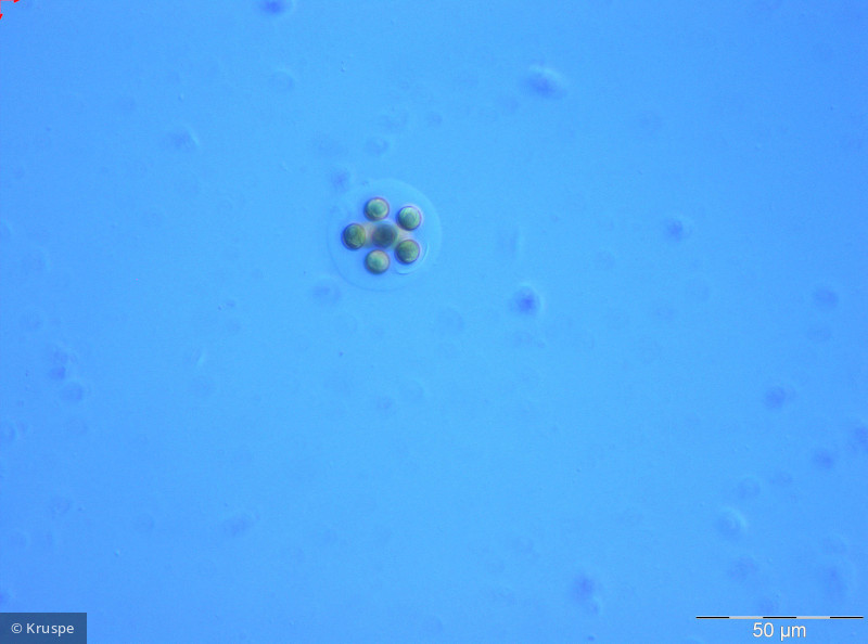 Planktosphaeria_gelatinosa_1260784740 - Chlorophyta Chlorophyceae Chlorococcales Planktosphaeria gelatinosa