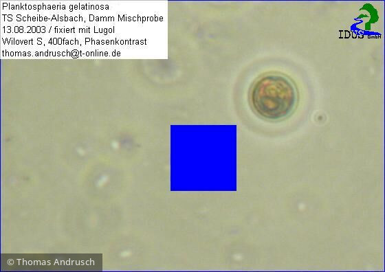 Chlorophyta Chlorophyceae Chlorococcales Planktosphaeria gelatinosa