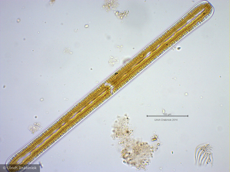 Heterocontophyta Bacillariophyceae Pennales Rhopalodia gibba