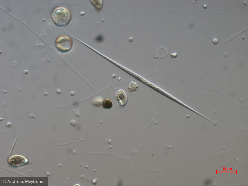 Monoraphidium_griffithi_1271148235 - Chlorophyta Chlorophyceae Chlorococcales Monoraphidium griffithii