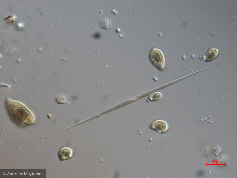 Monoraphidium_griffithi_1271148315 - Chlorophyta Chlorophyceae Chlorococcales Monoraphidium griffithii