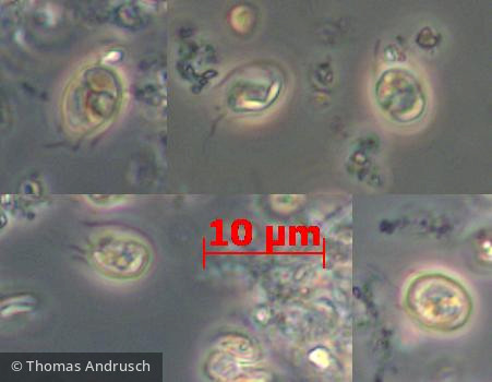 Heterocontophyta Chrysophyceae Chromulinales Pseudokephyrion hyalinum