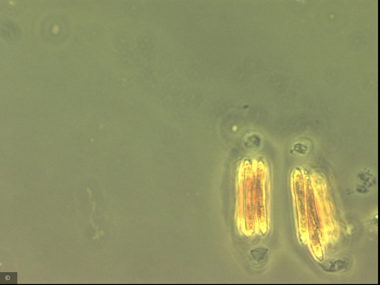 Quadrigula korsikovii &middot; Chlorophyta Chlorophyceae Chlorococcales
