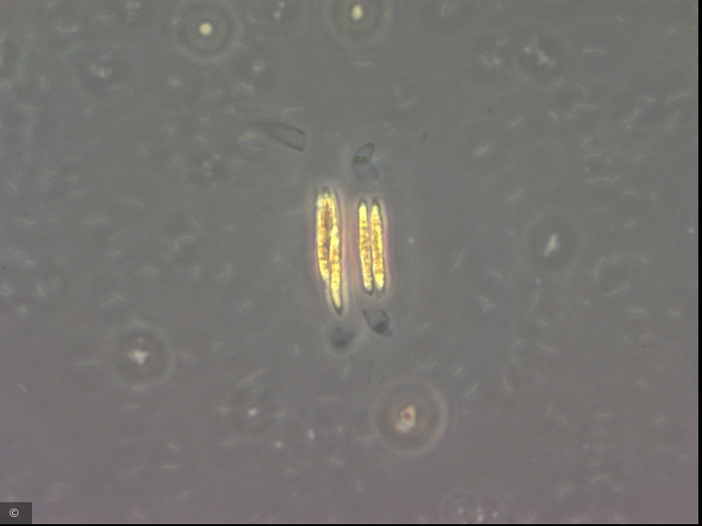 Quadrigula korsikovii &middot; Chlorophyta Chlorophyceae Chlorococcales