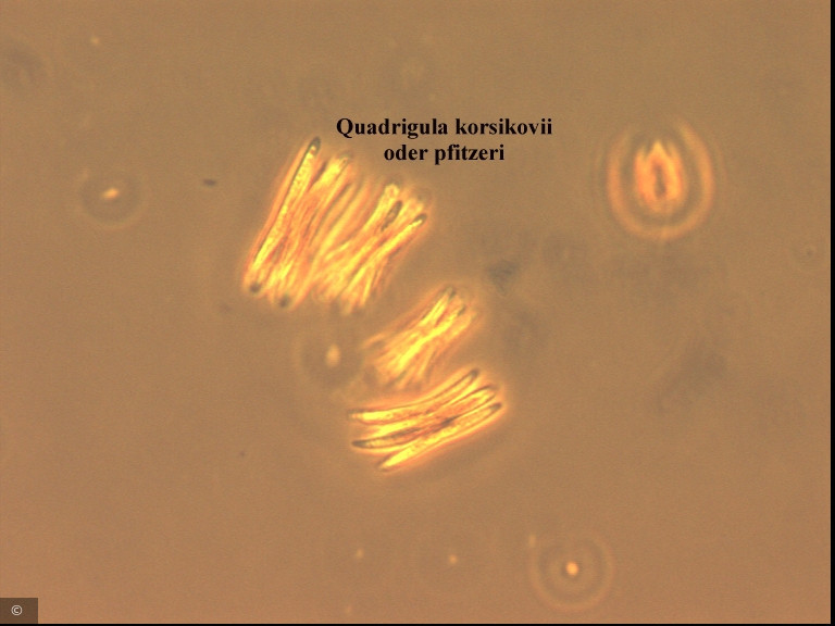 Quadrigula korsikovii &middot; Chlorophyta Chlorophyceae Chlorococcales