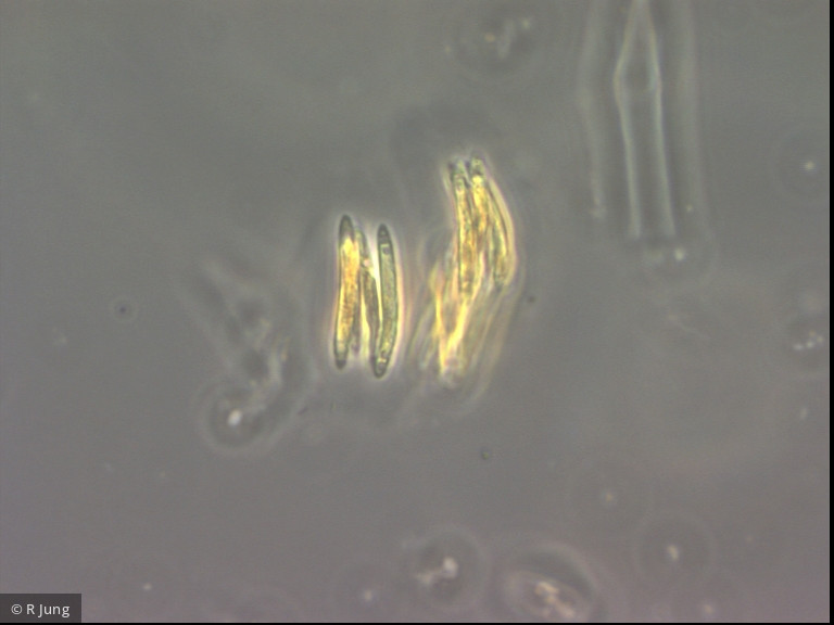 Quadrigula korsikovii &middot; Chlorophyta Chlorophyceae Chlorococcales &middot; 640 ffx
