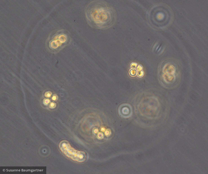 Chlorophyta Chlorophyceae Tetrasporales Pseudosphaerocystis lacustris