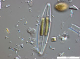 Navicula_lanceolata_1270558448