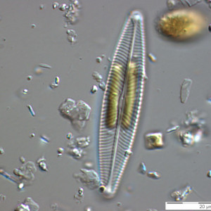 Navicula_lanceolata_1270558448