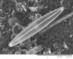 Navicula_lanceolata_1275306401