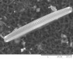 Navicula_lanceolata_1275307465