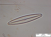 Navicula_lanceolata_1225985012