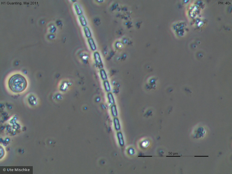 Chlorophyta Ulvophyceae Ulotrichales Planctonema lauterbornii