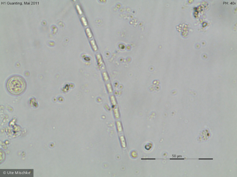 Chlorophyta Ulvophyceae Ulotrichales Planctonema lauterbornii
