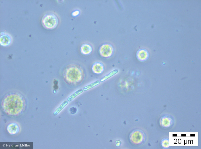 Chlorophyta Ulvophyceae Ulotrichales Planctonema lauterbornii