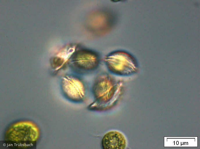 Phacotus_lenticularis_1253626853 - Chlorophyta Chlorophyceae Volvocales Phacotus lenticularis