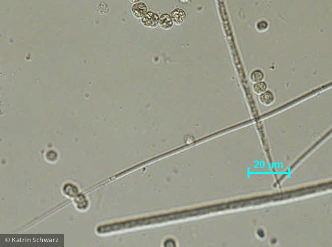 Cyanobacteria Cyanobacteria Oscillatoriales Planktolyngbya limnetica