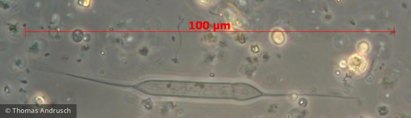 Heterocontophyta Bacillariophyceae Centrales Rhizosolenia longiseta