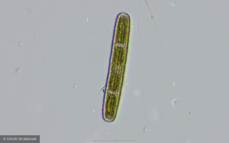 Chlorophyta Conjugatophyceae Desmidiales Penium margaritaceum