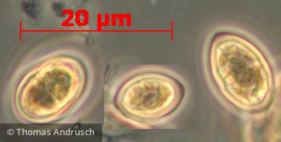 Chlorophyta Chlorophyceae Chlorococcales Oocystis marssonii