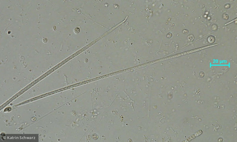 Cyanobacteria Cyanobacteria Nostocales Raphidiopsis mediterranea