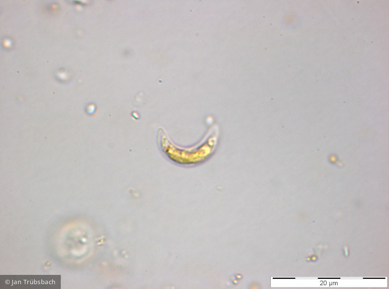 Chlorophyta Chlorophyceae Chlorococcales Monoraphidium minutum