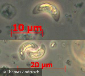 Chlorophyta Chlorophyceae Chlorococcales Monoraphidium minutum