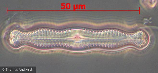Heterocontophyta Bacillariophyceae Pennales Pinnularia nodosa