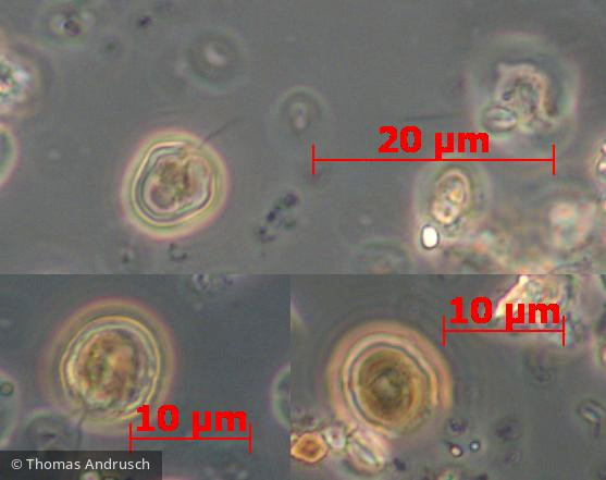 Heterocontophyta Chrysophyceae Chromulinales Pseudokephyrion ovum