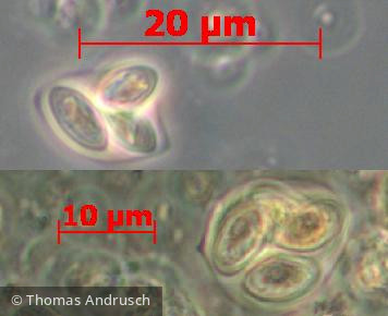 Chlorophyta Chlorophyceae Chlorococcales Oocystis parva