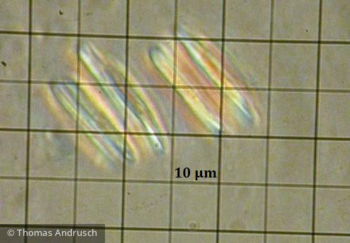 Chlorophyta Chlorophyceae Chlorococcales Quadrigula pfitzeri