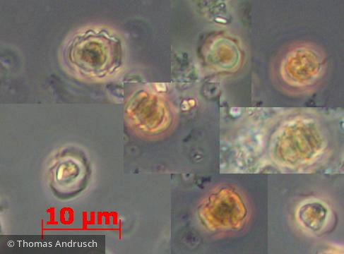 Heterocontophyta Chrysophyceae Chromulinales Pseudokephyrion pseudospirale